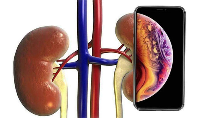 iPhone and Kidney meme